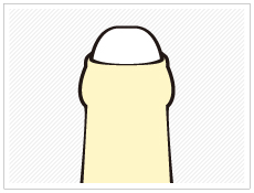 仮性包茎